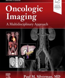 Oncologic Imaging A Multidisciplinary Approach 2nd Edition